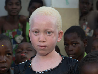 Annie ser inn i kameraet. Rundt henne st&aring;r andre afrikanske barn. 